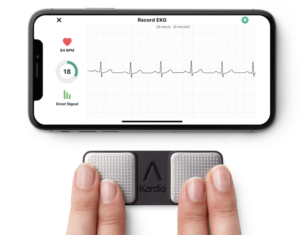 ekg